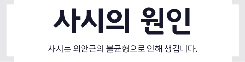 사시의 원인